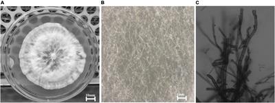 Broad-Spectrum Antimicrobial Action of Cell-Free Culture Extracts and Volatile Organic Compounds Produced by Endophytic Fungi <mark class="highlighted">Curvularia</mark> Eragrostidis